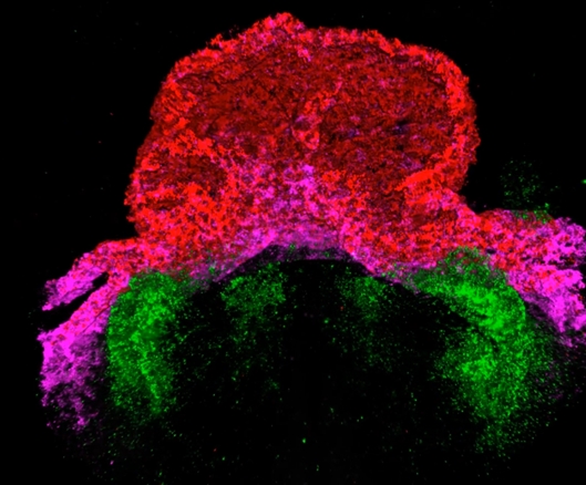 一個(gè)細(xì)胞一個(gè)細(xì)胞地跟蹤早期心臟形成 一個(gè)細(xì)胞一個(gè)細(xì)胞地跟蹤早期心臟形成