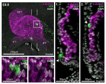 跟蹤早期心臟形成 跟蹤早期心臟形成