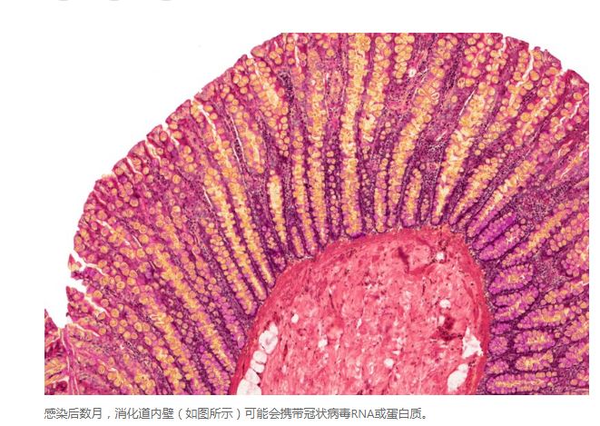 COVID研究更新:免疫細胞“記住” COVID至少半年 COVID研究更新:免疫細胞“記住” COVID至少半年