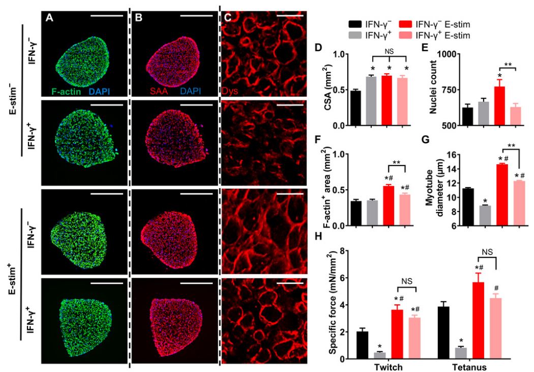 E-刺激可防止IFN-γ引起的肌管長度，肌小節(jié)豐度和收縮蛋白表達減少