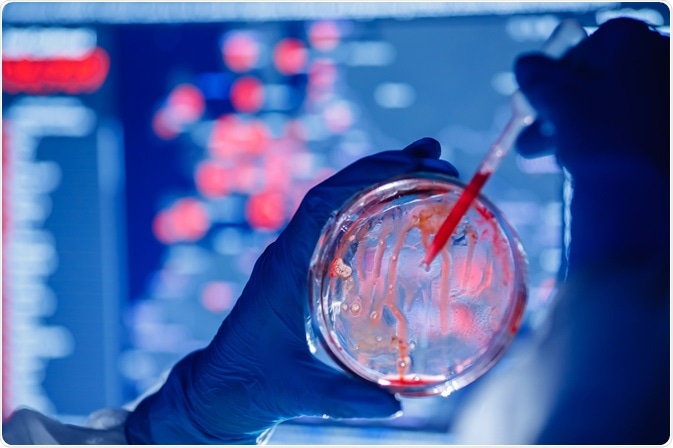 微生物鑒定的生化檢驗(yàn)方法 微生物鑒定的生化檢驗(yàn)方法