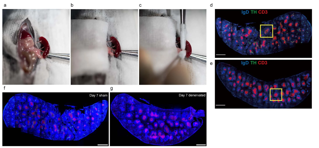 脾神經(jīng)支配及其在T非依賴性反應(yīng)中對漿細(xì)胞形成的影響缺乏