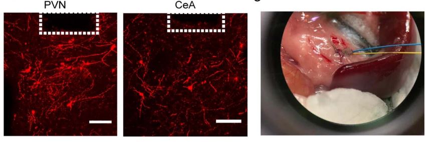 將光纖植入大腦的PVN和CeA區(qū)。紅色，ChR2 +神經(jīng)元。電極植入脾神經(jīng)周圍