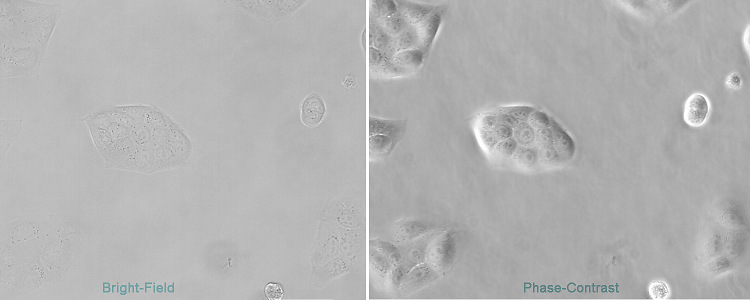Leica DMiL、DM IL LED Leica DMi8倒置顯微鏡明場-相差細(xì)胞圖像的對比度比較.jpg