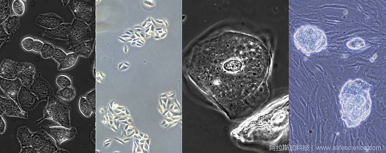 蔡司Primovert 徠卡DMiL Olympus CKX53 舜宇I(lǐng)CX41 Motic AE2000倒置相差顯微鏡細(xì)胞圖像中的偽影.jpg 蔡司Primovert 徠卡DMiL Olympus CKX53 舜宇I(lǐng)CX41 Motic AE2000倒置相差顯微鏡細(xì)胞圖像中的偽影.jpg